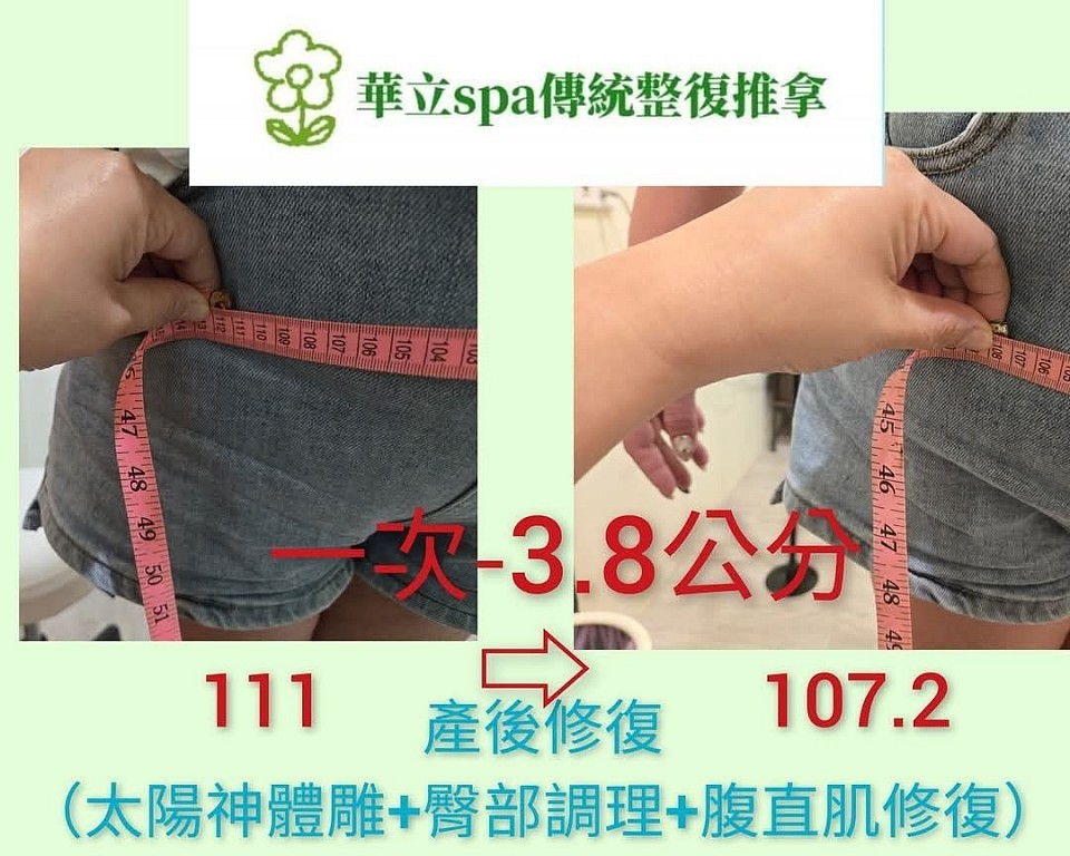 產後骨盆喬骨