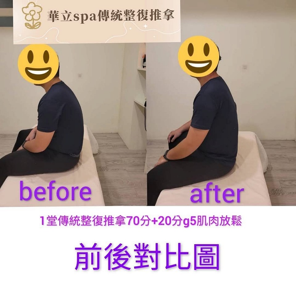 華立SPA傳統整復推拿前後對比圖，顯示顧客經過一堂70分鐘整復推拿＋20分鐘G5肌肉放鬆後，身體姿勢明顯改善，駝背狀況明顯改善，體態更挺直