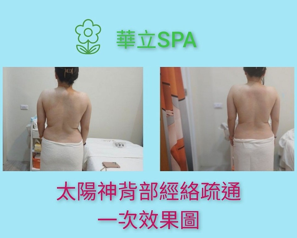 太陽神儀器背部經絡疏通｜一次療程前後效果圖 這張實拍對比照顯示，經過一次太陽神儀器操作後，背部線條明顯放鬆、身形更對稱。 本療程透過儀器深入刺激經絡，有效改善背部緊繃、淋巴堵塞、水腫與肩背僵硬等問題。 適合長期久坐上班族、肩頸痠痛者、經絡循環不良者。 【華立SPA】提供專業經絡疏通服務，搭配太陽神能量儀器，打造身體從內而外的輕盈感！