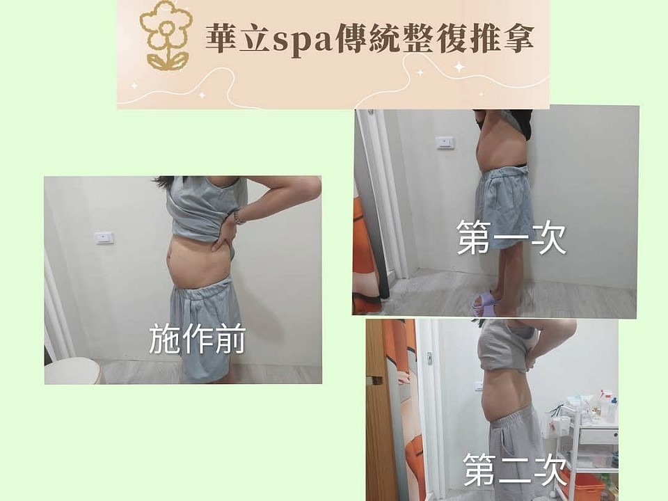 產後腹直肌修復＋體雕｜一次療程前後效果圖 產後腹直肌分離會導致小腹凸出、核心無力、腰痠背痛等問題。 華立SPA運用專業腹直肌修復手技，結合體雕課程，針對鬆弛肌群加強收緊與雕塑。 一次療程就能看見腹部線條緊實、整體體態更輕盈！ 照片為實際客戶修復紀錄，專為產後媽媽量身打造，從根本改善體型與不適，找回自信與力量❁