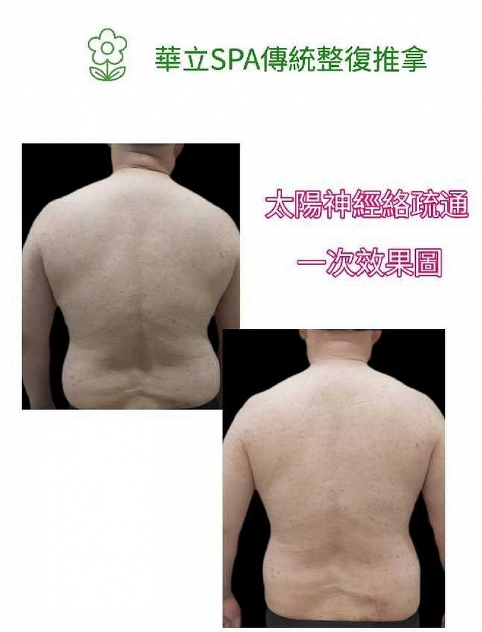 「華立SPA太陽神經絡疏通，一次療程立即有感，改善背部緊繃與氣血不順，立即體驗傳統整復推拿的神奇效果！」