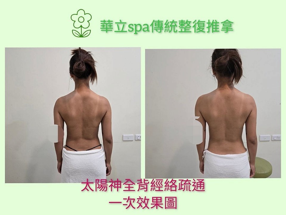 🌿【太陽神經絡疏通・背部線條立現】 📍華立spa傳統整復推拿 只做一次，就讓肩線平整、背影更輕盈🌸 💚真人實拍・一次療程效果如圖 📩 歡迎預約體驗